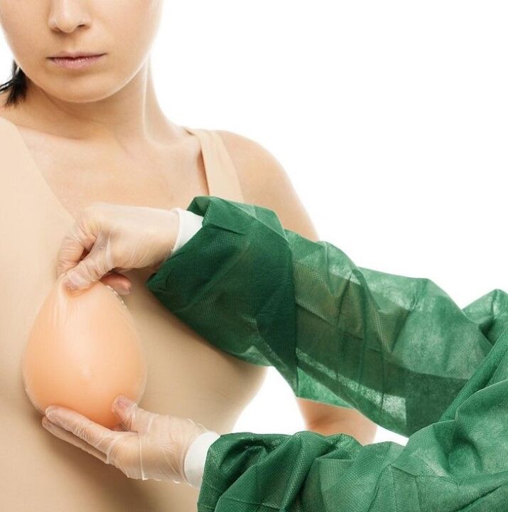 protesi per l'aumento del seno